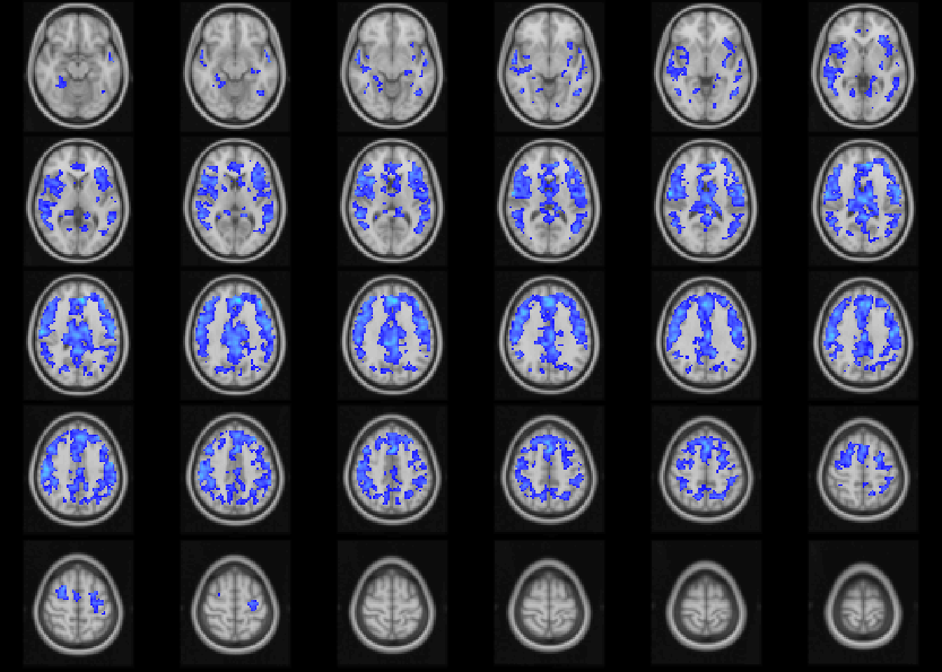 Age-related differences in fALFF controlling for sex, diagnosis, motion, and site. Colors are signed RESI values showing uncorrected $S\ge 0.1$. for slices `z=20:49`.