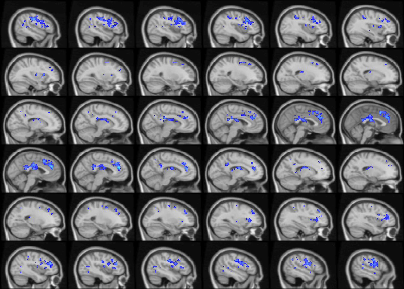 Age-related differences in fALFF controlling for sex, diagnosis, motion, and site. Colors are signed RESI values showing uncorrected $S \ge 0.1$. for slices `x=14:49`.