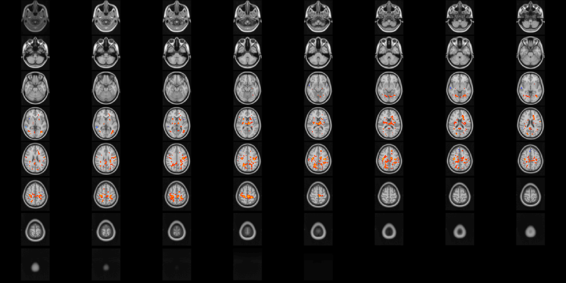 Diagnostic differences in fALFF controlling for sex, age, motion, and site. Colors are signed -log10(p) values showing uncorrected $p \le 0.05$.