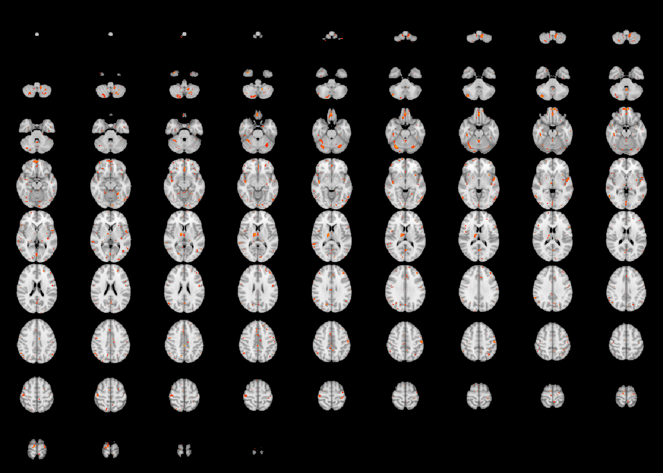 An example of a custom layout for the test of the age by sex interaction, with a CFT of $p=0.01$.