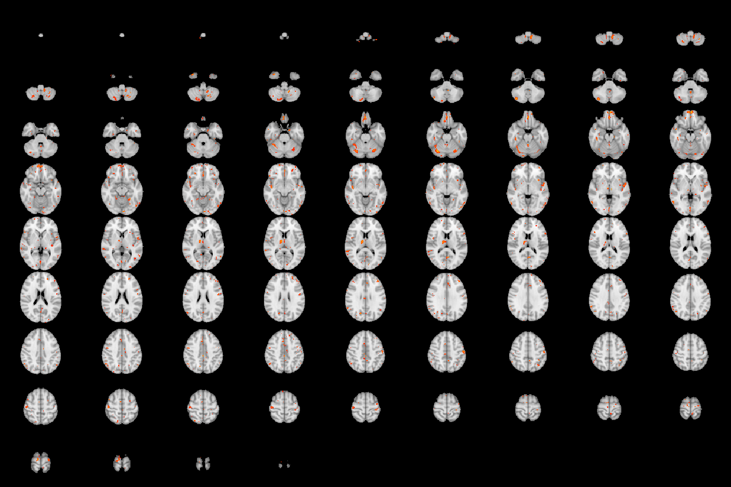 Lightbox view of results for the test of the age by sex interaction, with a CFT of $p=0.01$.