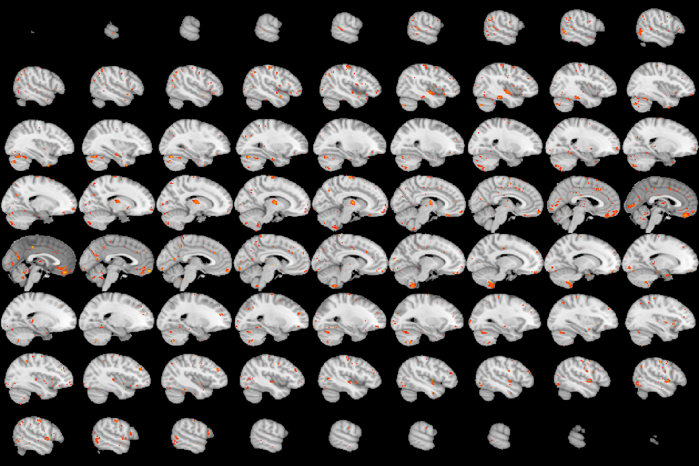 Sagittal lightbox view of results for the test of the age by sex interaction, with a CFT of $p=0.01$.